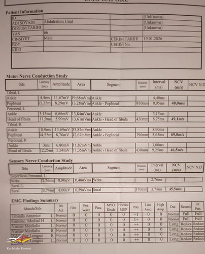 EMG incelemesi, değerler.