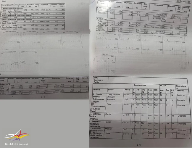 4.3.2026 tarihli son EMG.