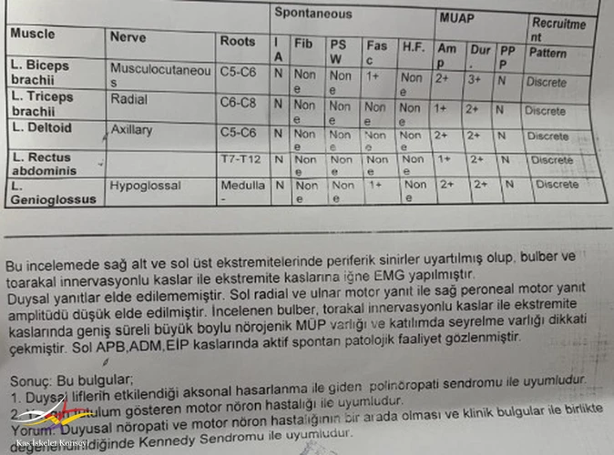 4.3.2026 tarihli son EMG raporu.