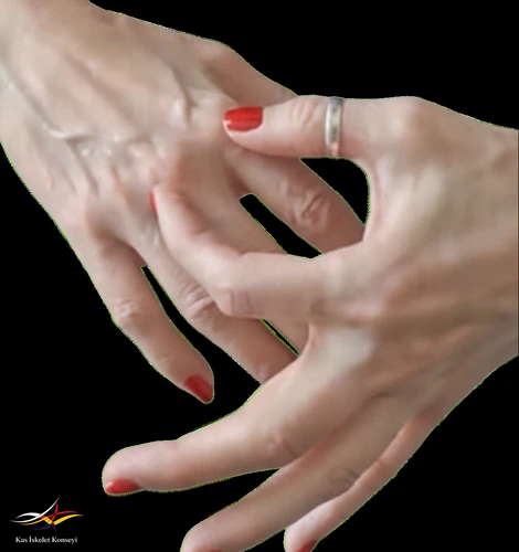 Ellerdeki ağrı bölgesi tarif ediliyor.